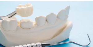 my-dentist.com.au dental crowns Adelaide